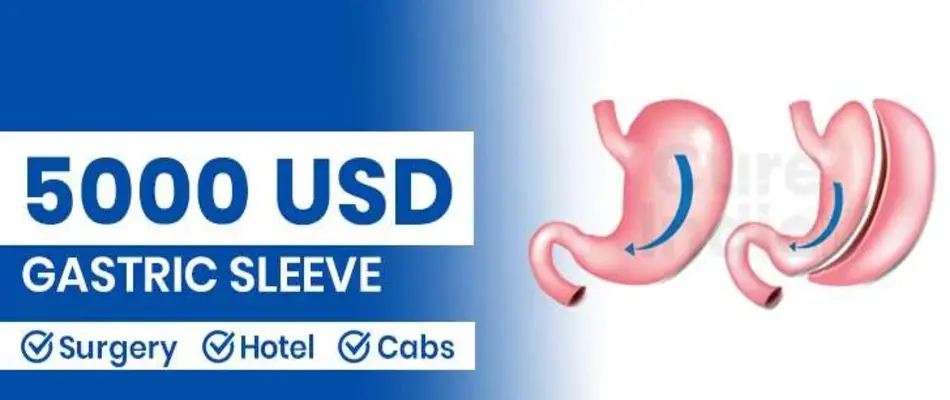 Gastric Sleeve Cost